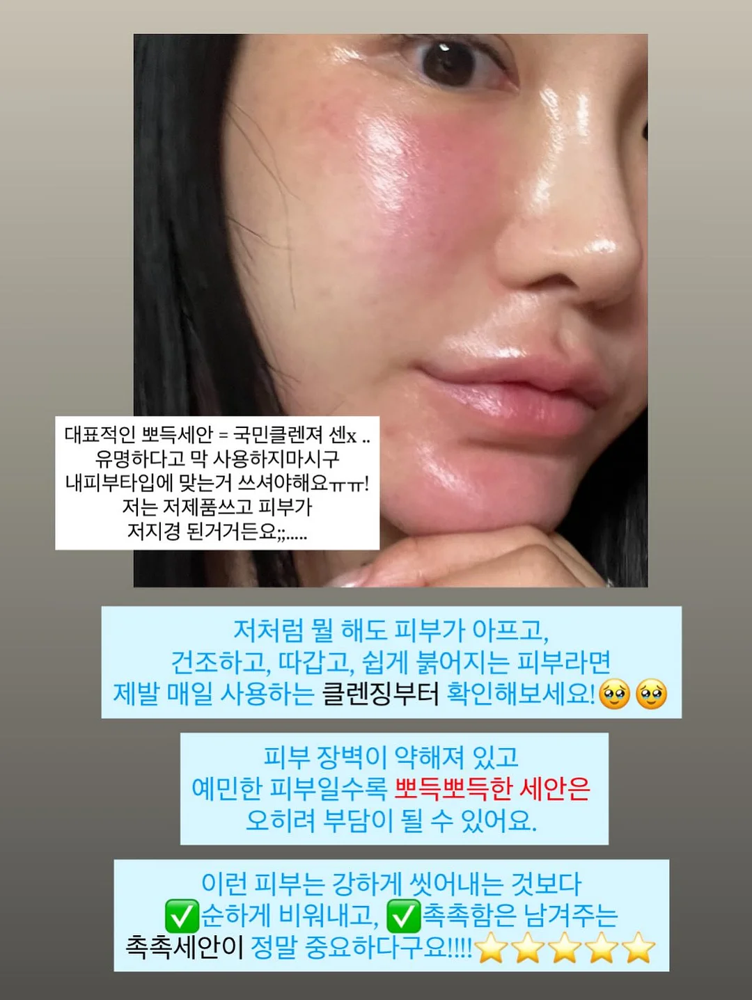 텐셀 원피스 11