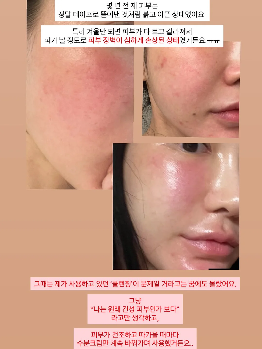 텐셀 원피스 4