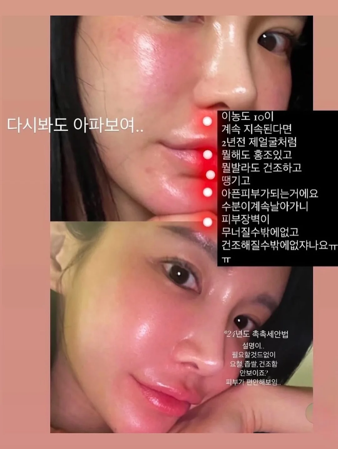 텐셀 원피스 8