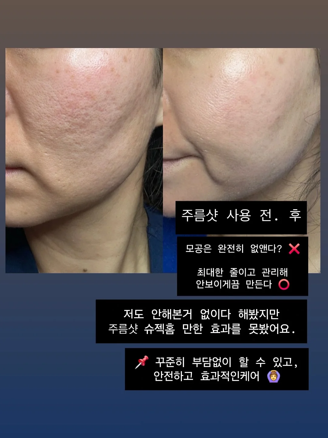 기능성 잡곡밥 7