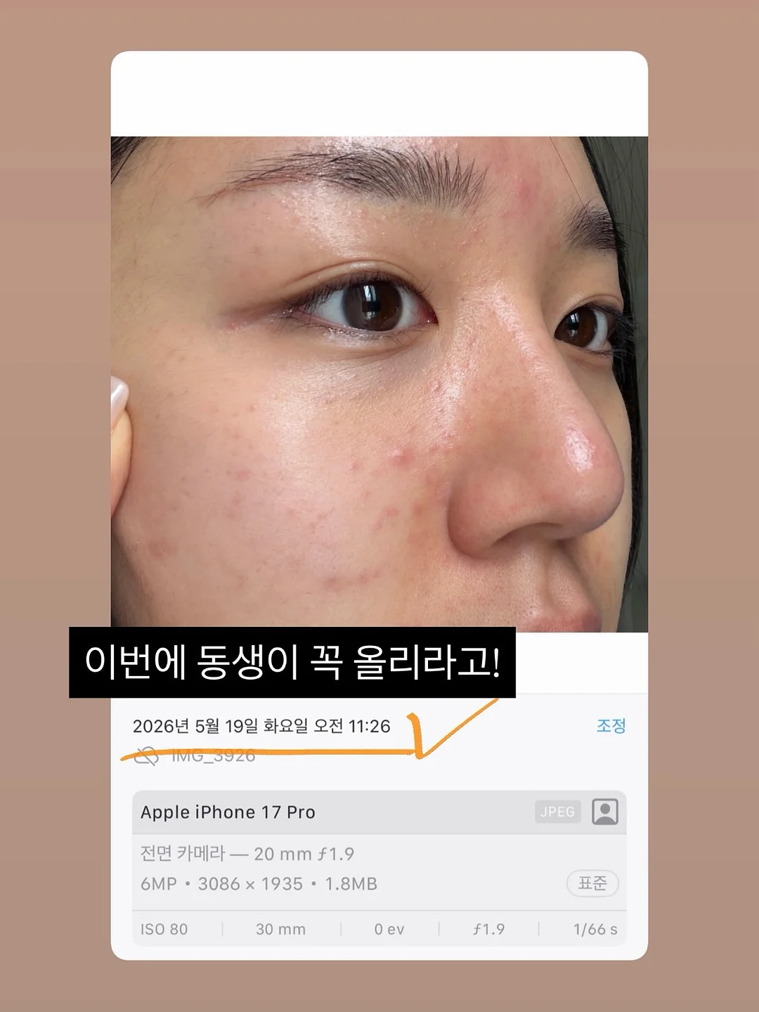 셀리셋필링 12