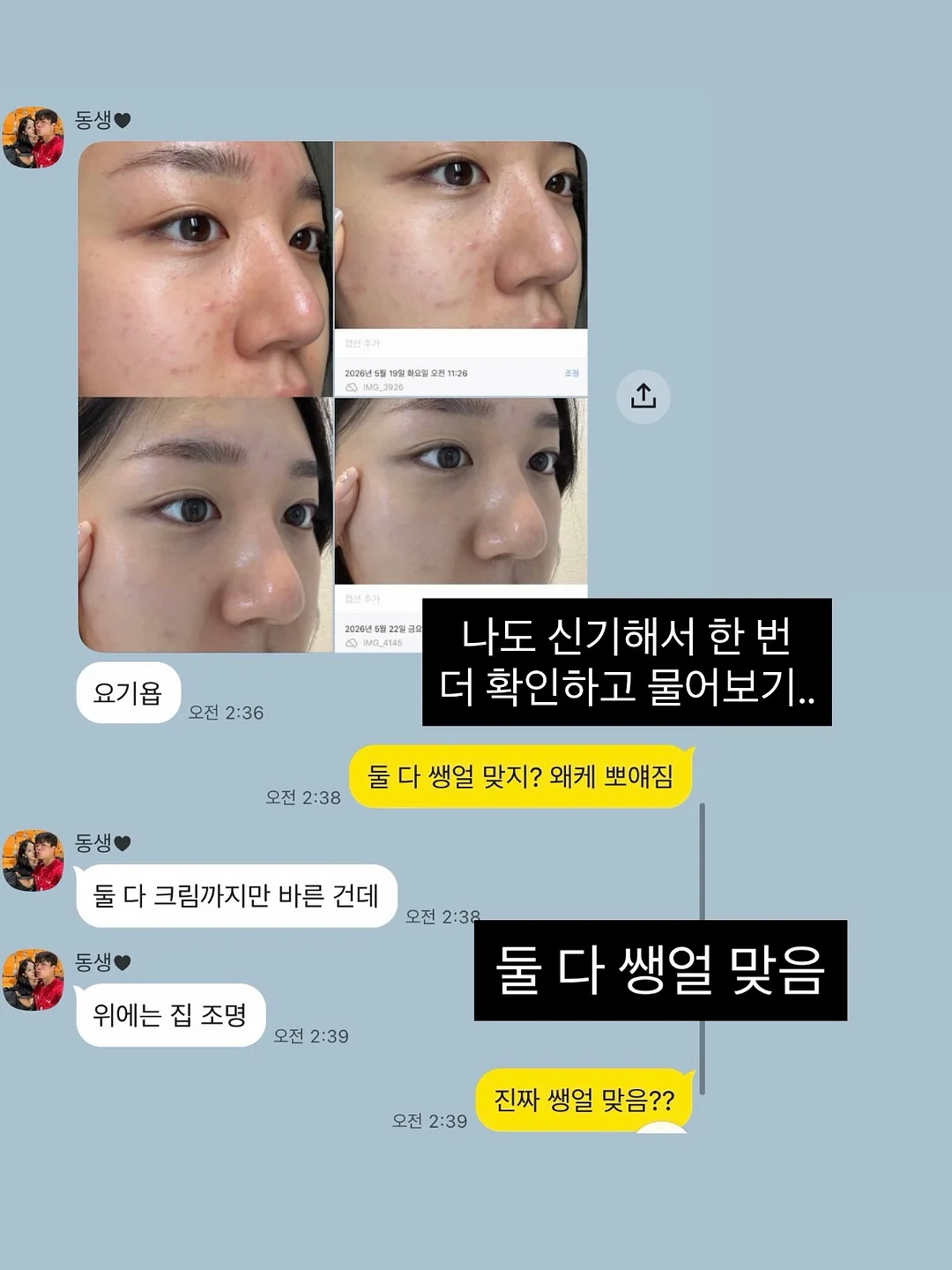 셀리셋필링 14