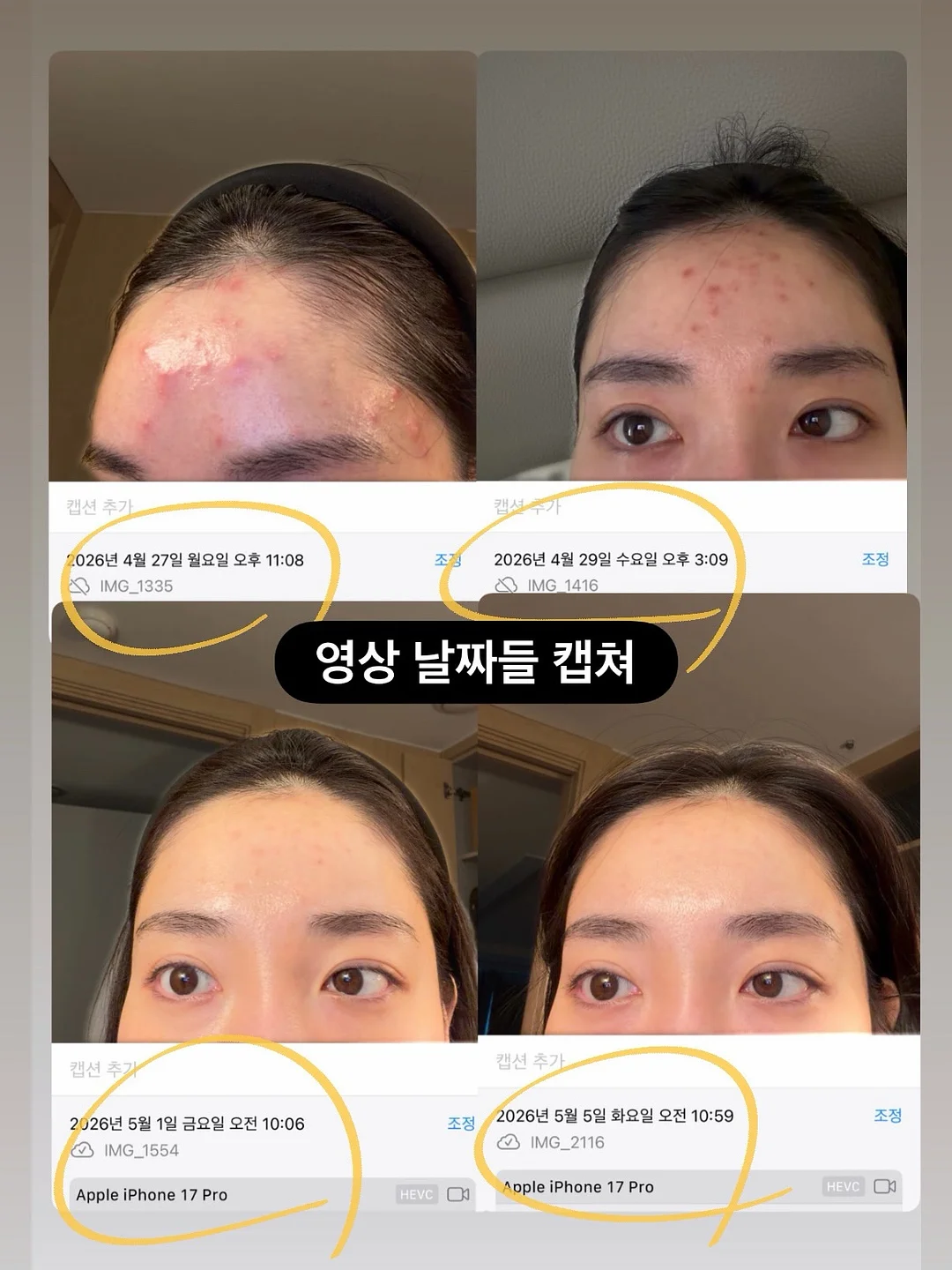 셀리셋필링 7