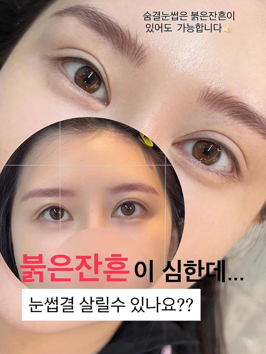 곰팡이 제거제 1