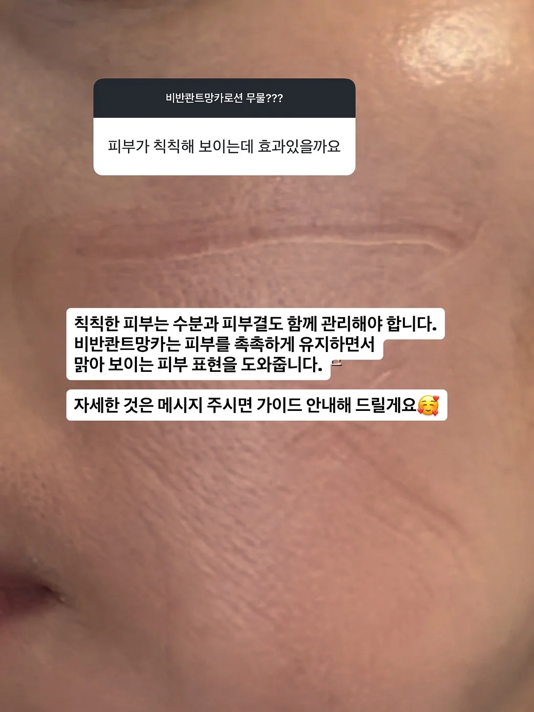 미니 멜리사 헬로 키티 샌들 13