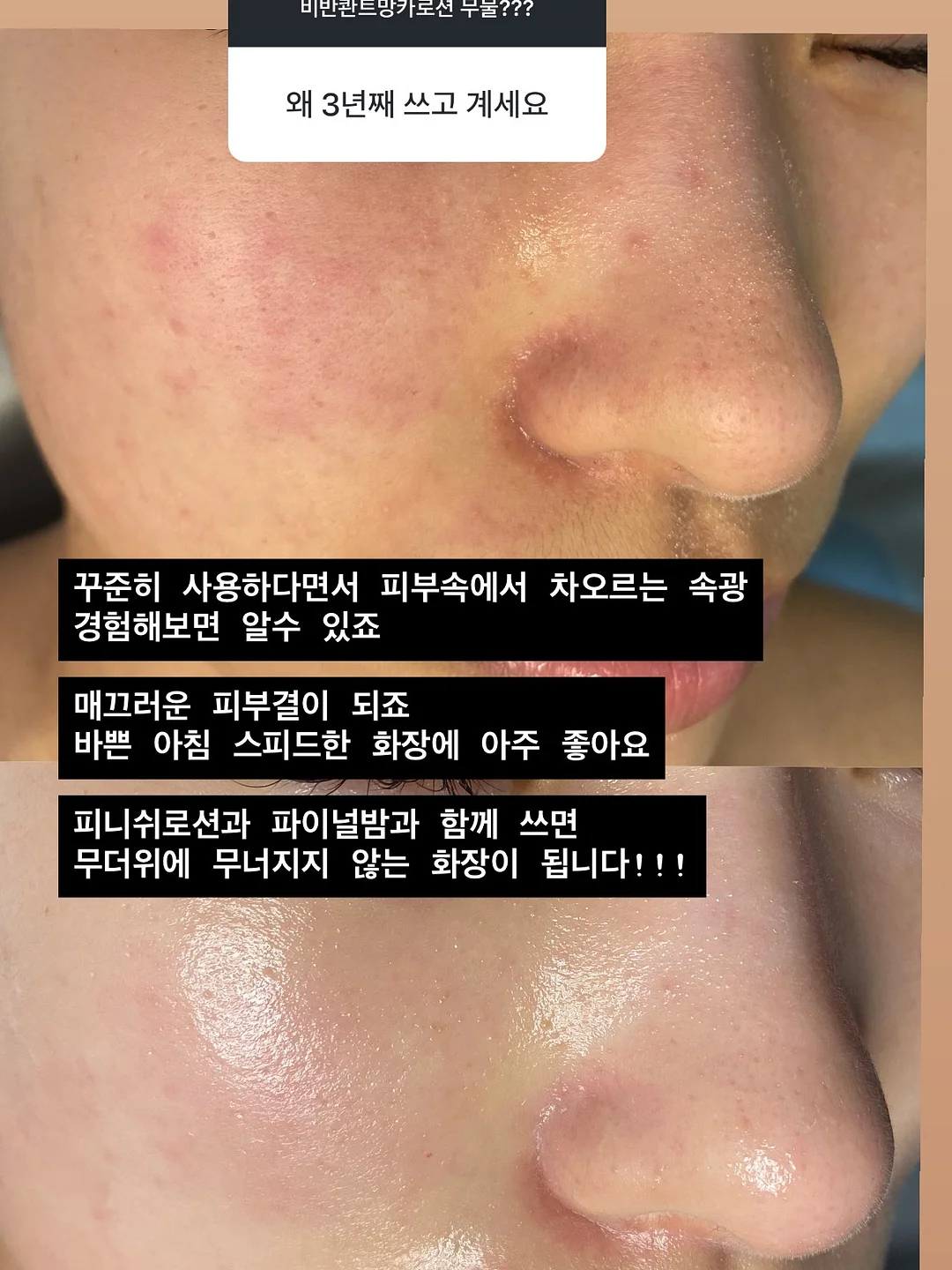 미니 멜리사 헬로 키티 샌들 2
