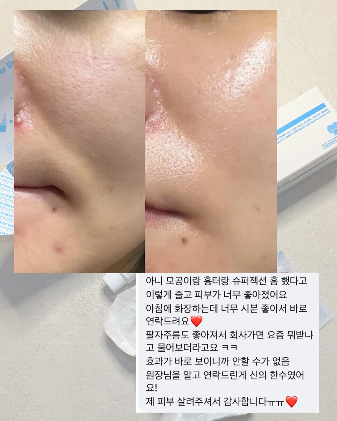 수도권 2억대 아파트 2