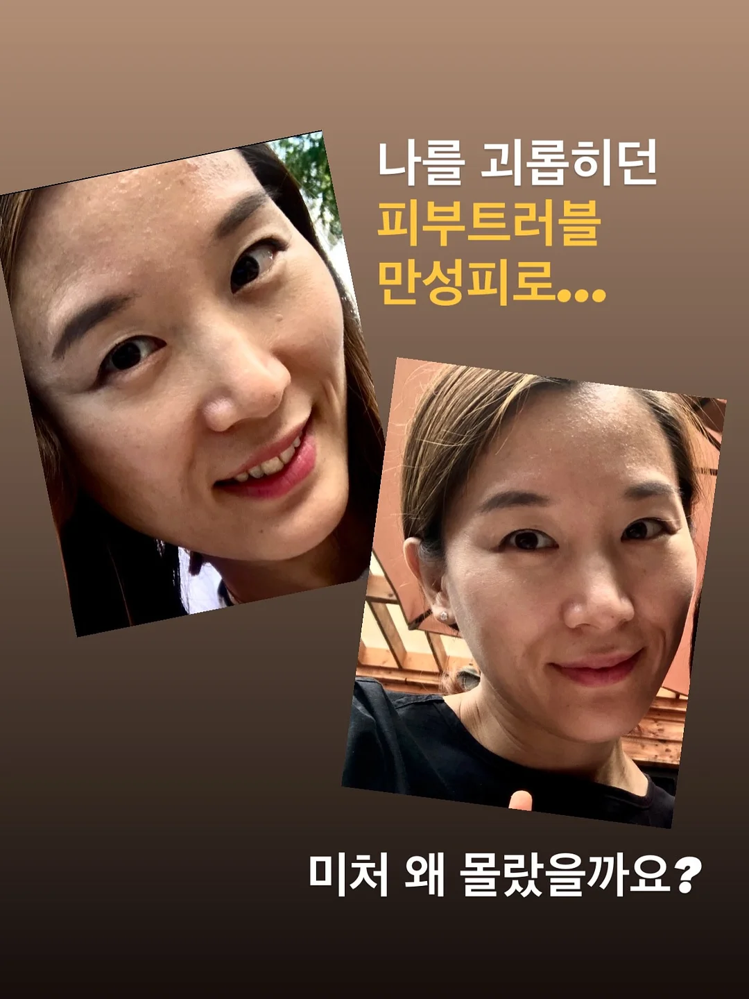 레고 보태니컬 핑크 장미 꽃다발 2