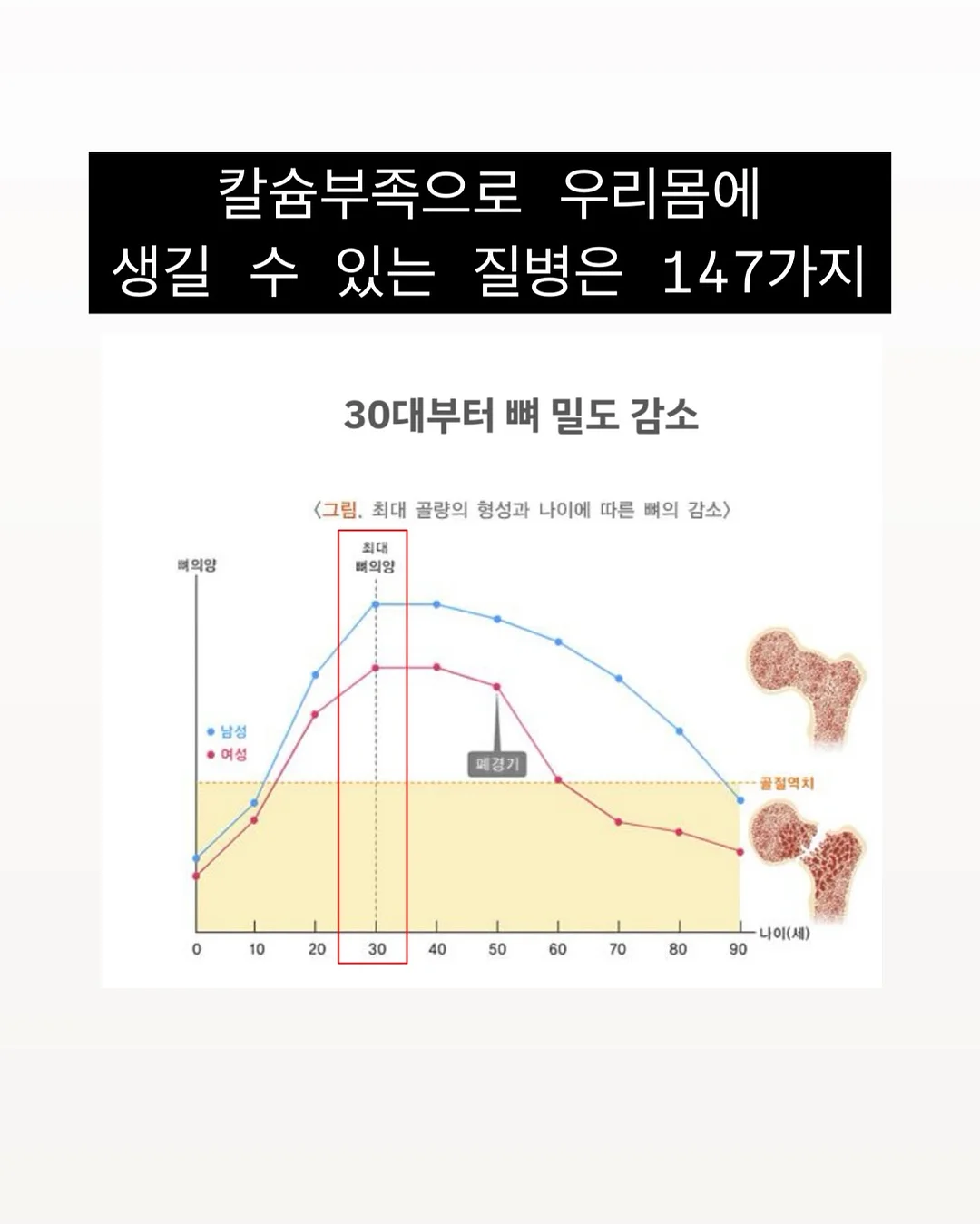 현관문 보안 장치 13