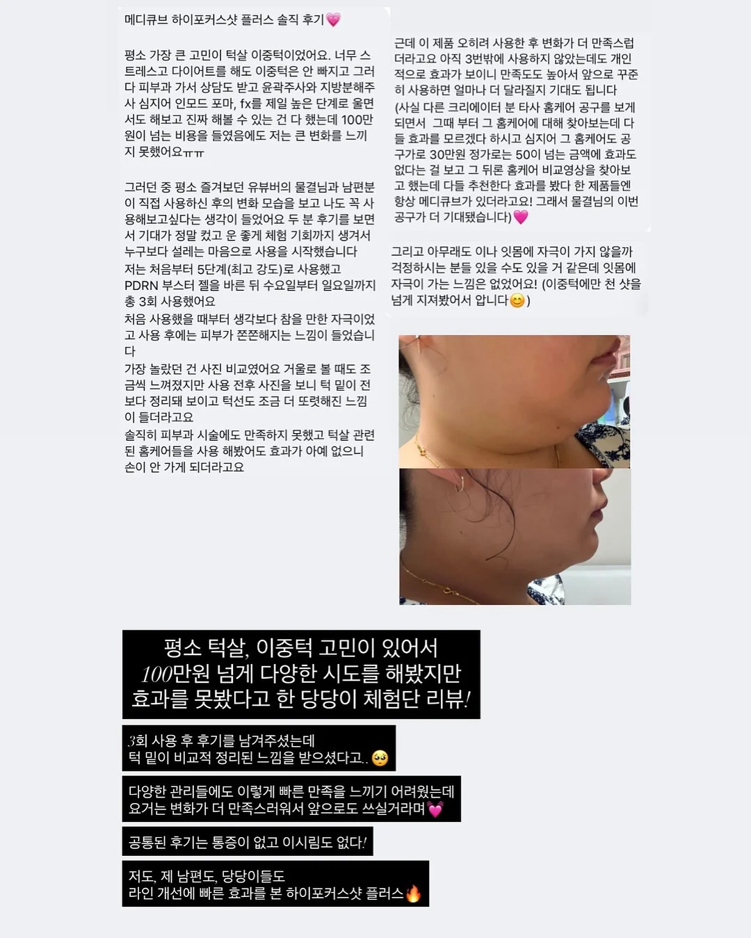 빵빵 스크런치 13