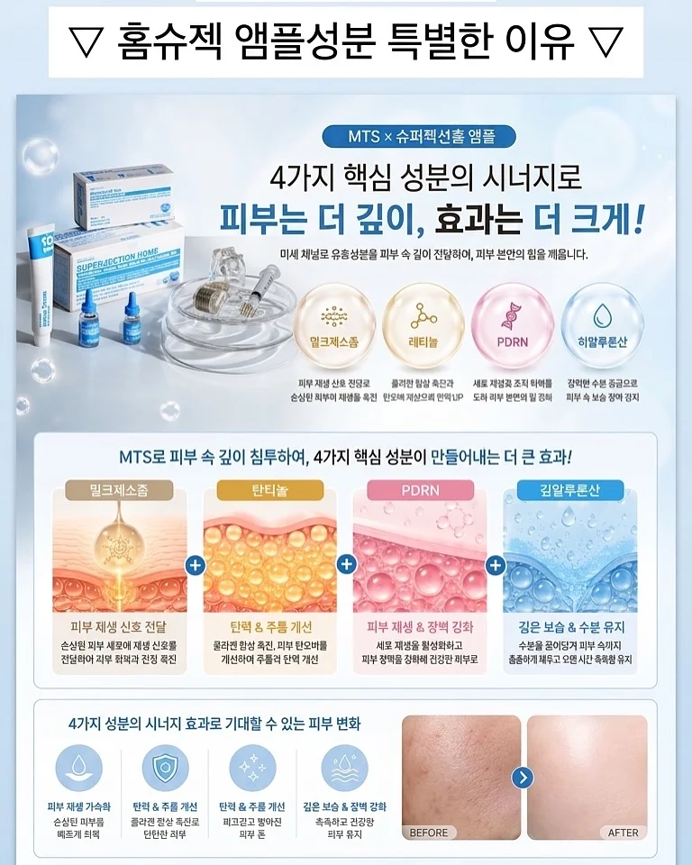 앞뒤 자수 감성 루즈핏 티셔츠 & 레이어드 레이스 밴딩 자수치마 세트 5
