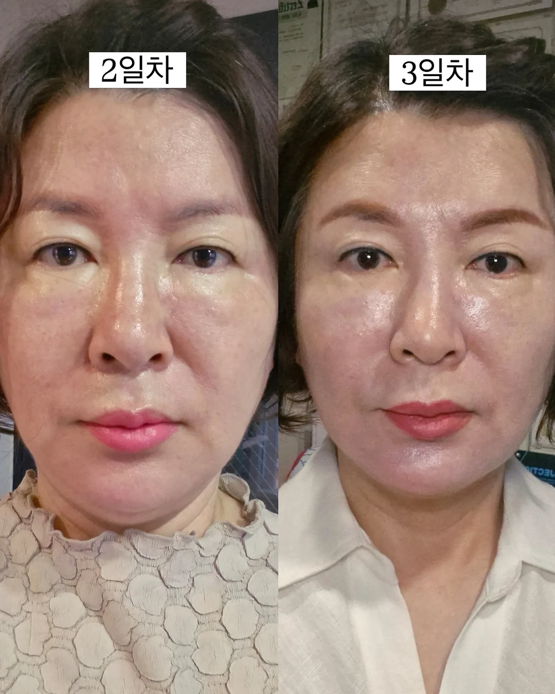 키즐키즐 시리얼 4