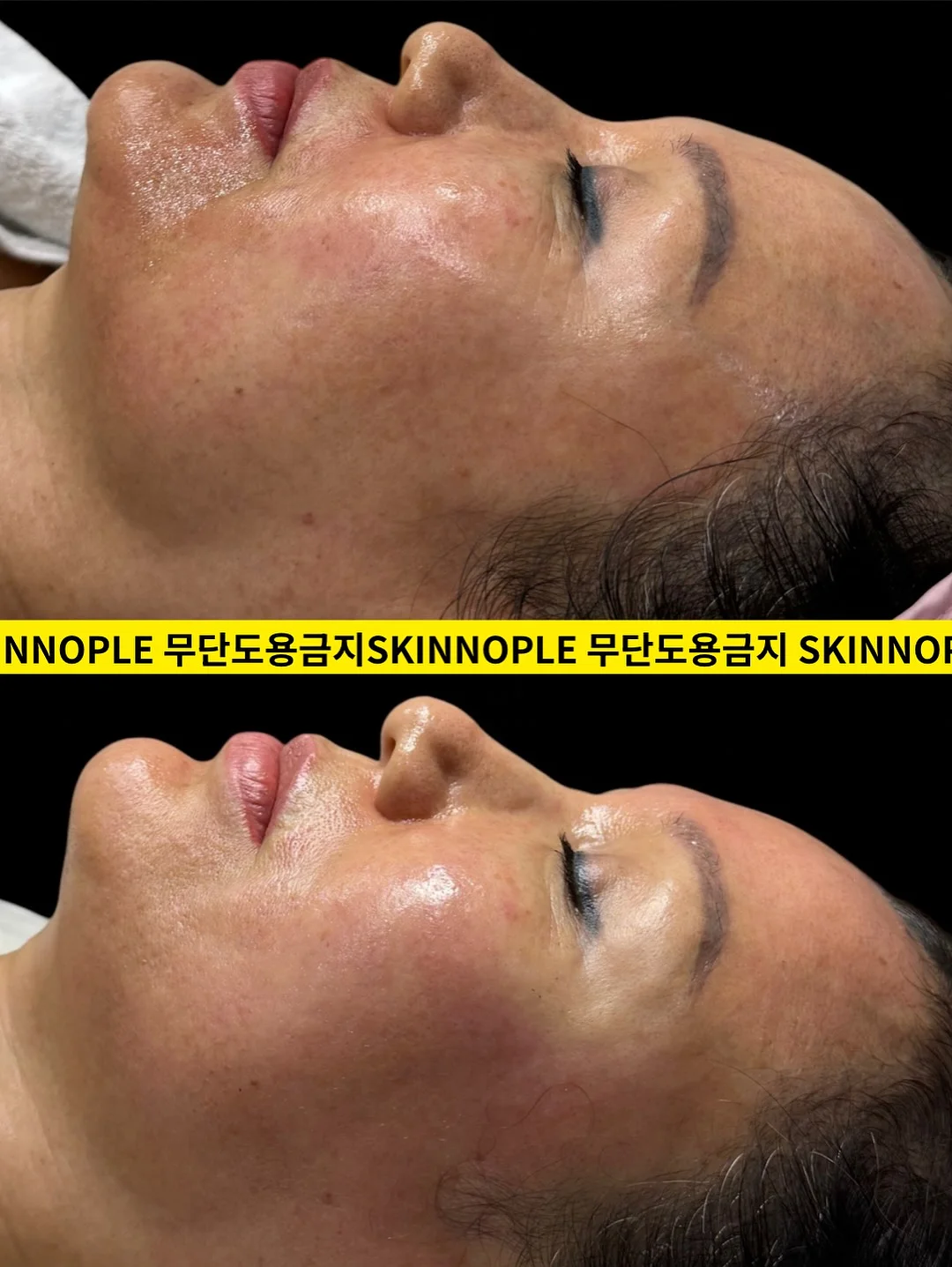 유기농 컬리케일 스틱 3