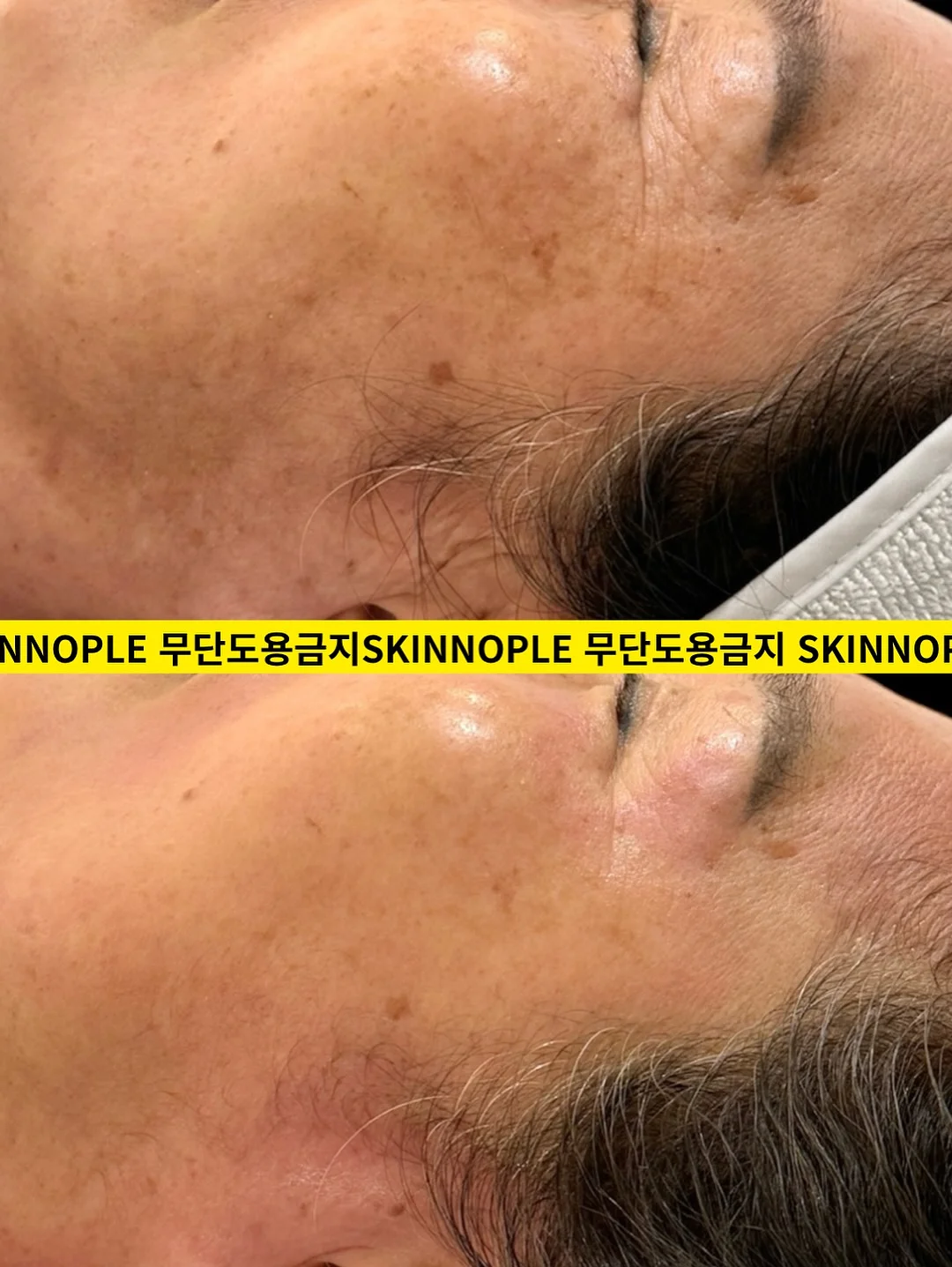 유기농 컬리케일 스틱 4