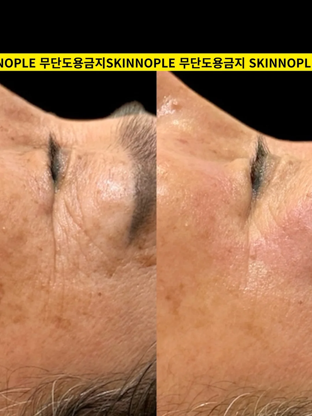 유기농 컬리케일 스틱 6