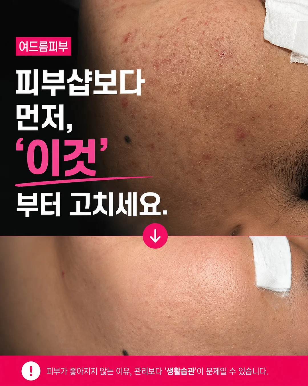미니 우산 1