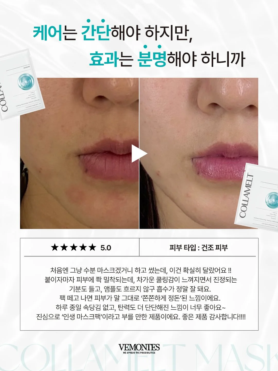 피오레버 이어링 3