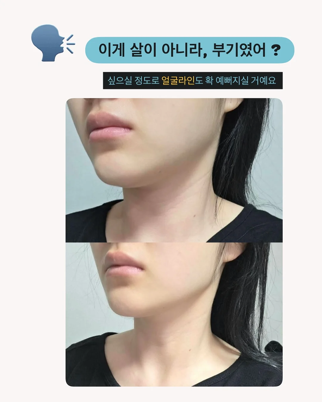 샐러드 10