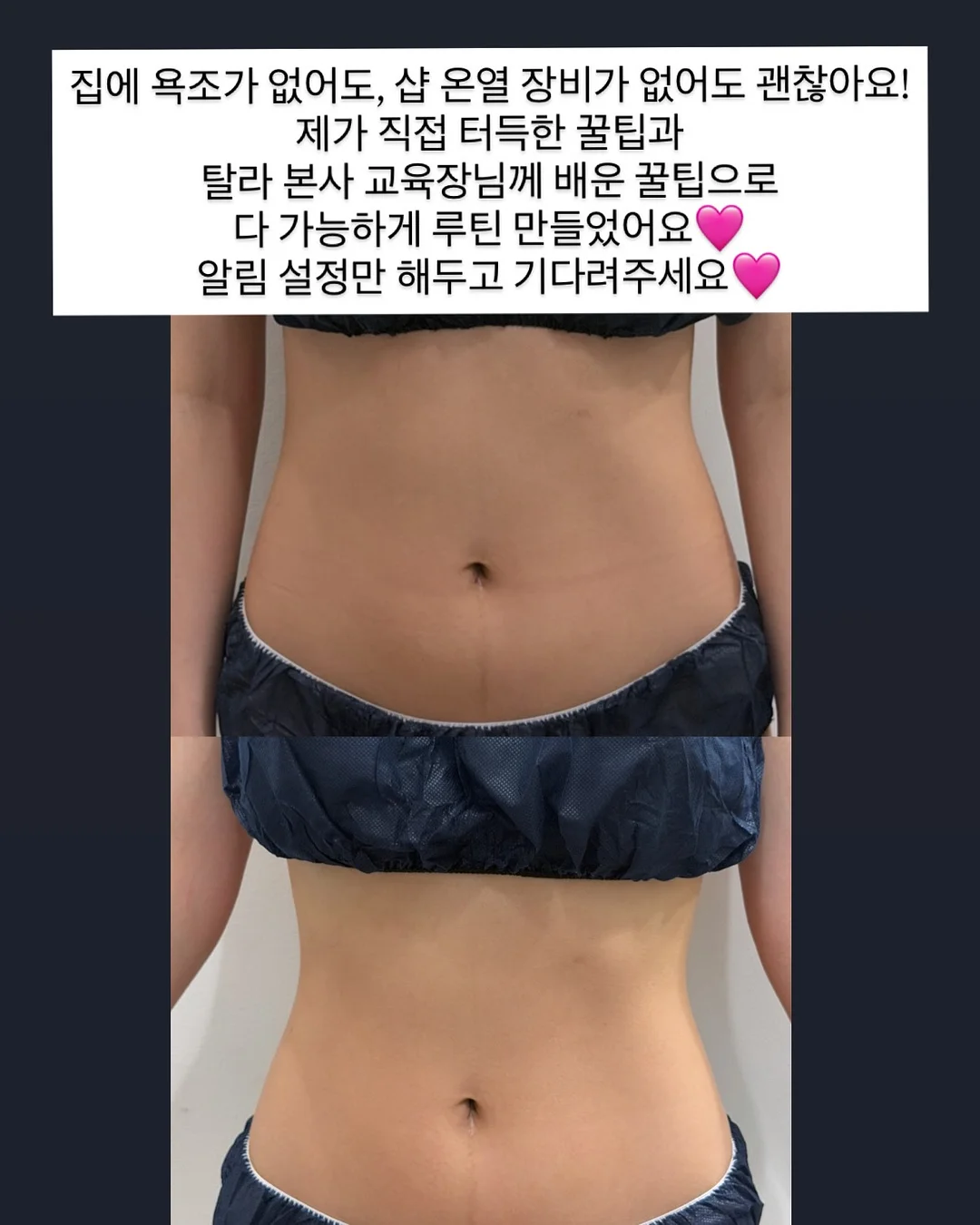 원피스 11