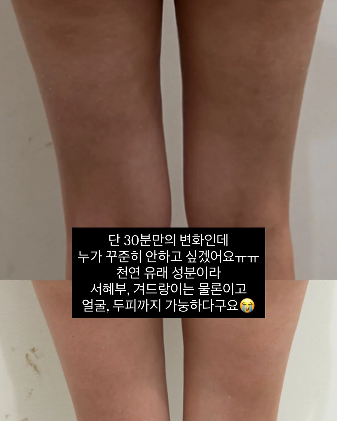원피스 9