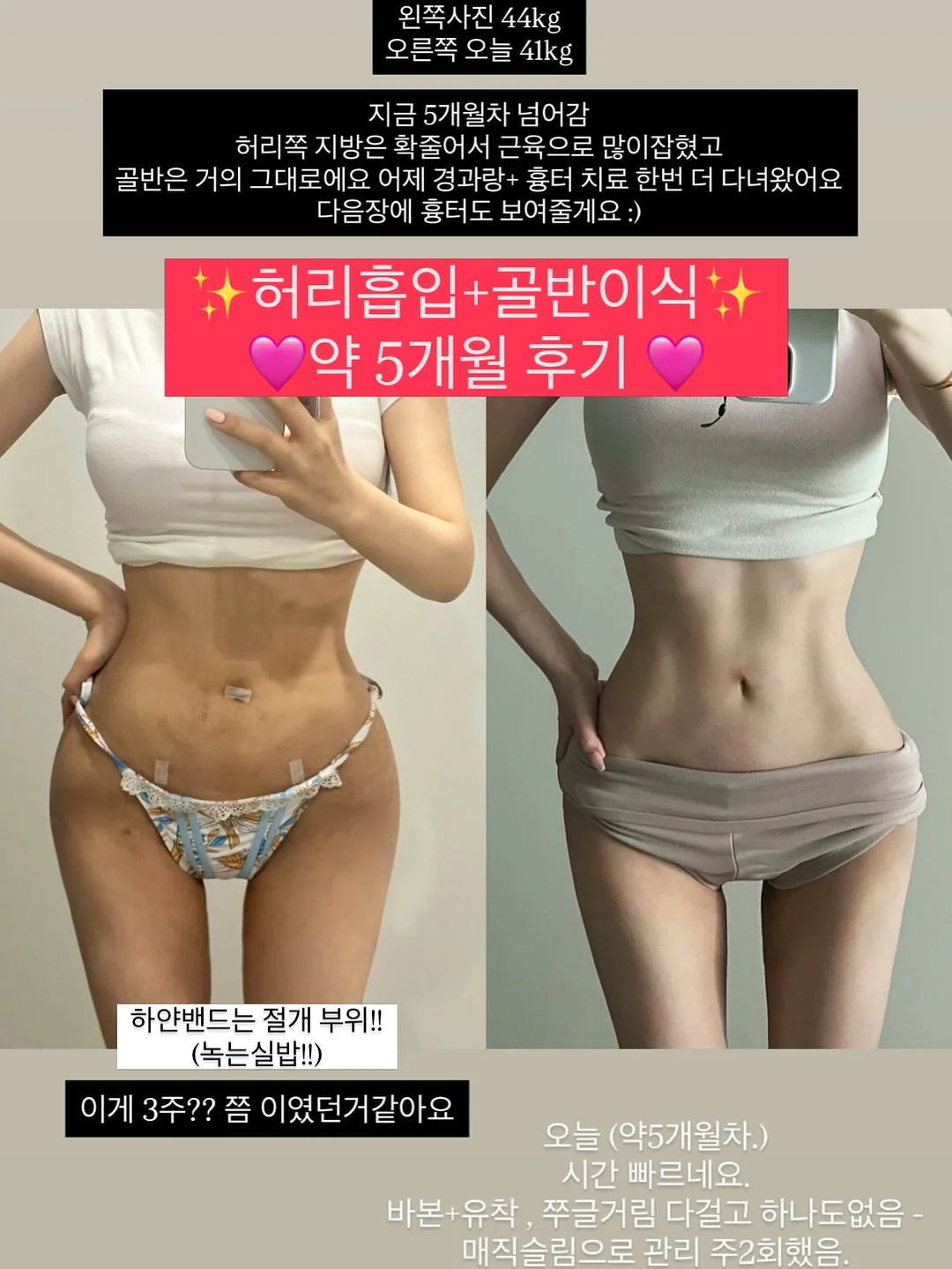 괄사스틱 마사지스틱 1