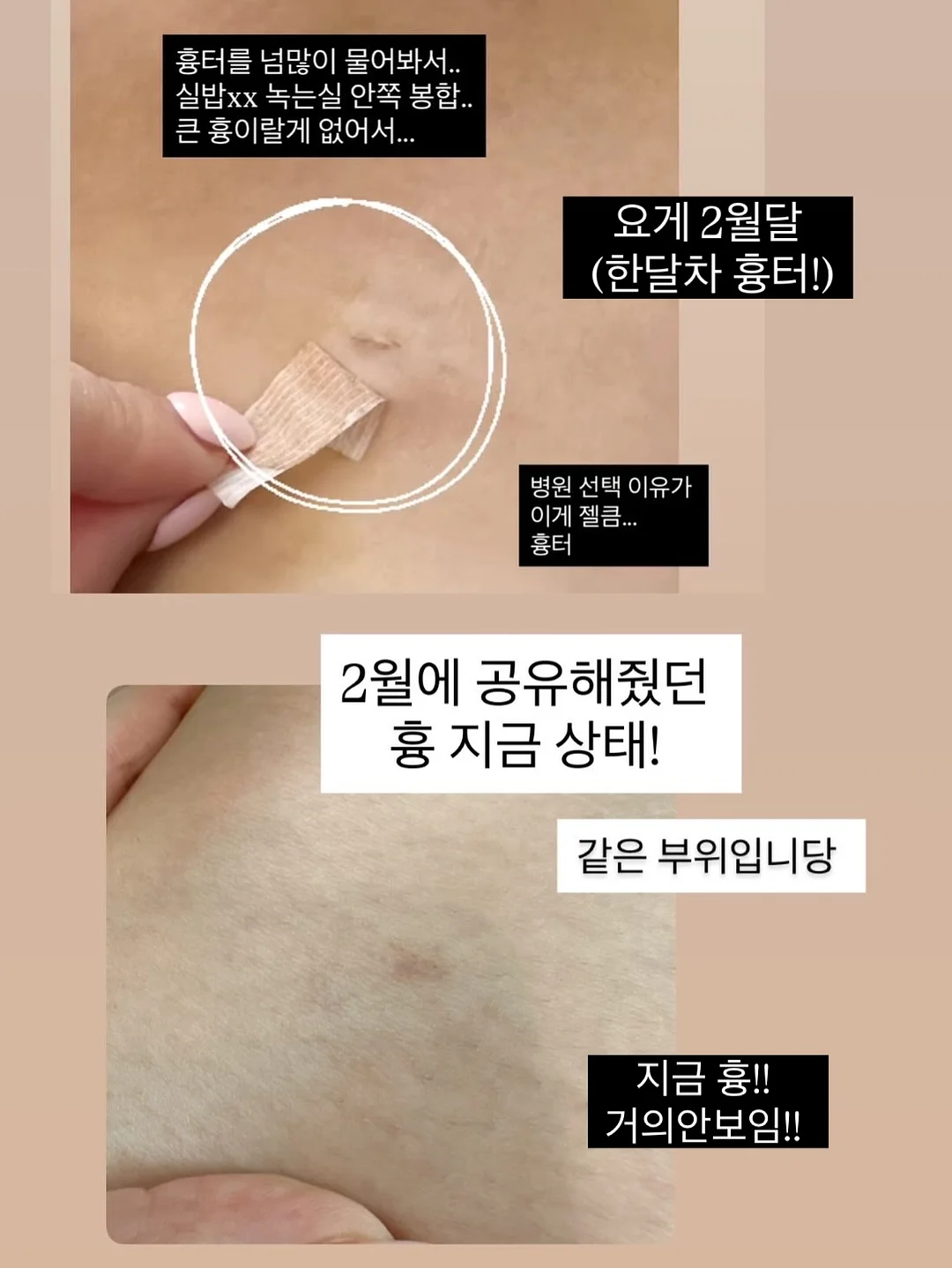 괄사스틱 마사지스틱 2