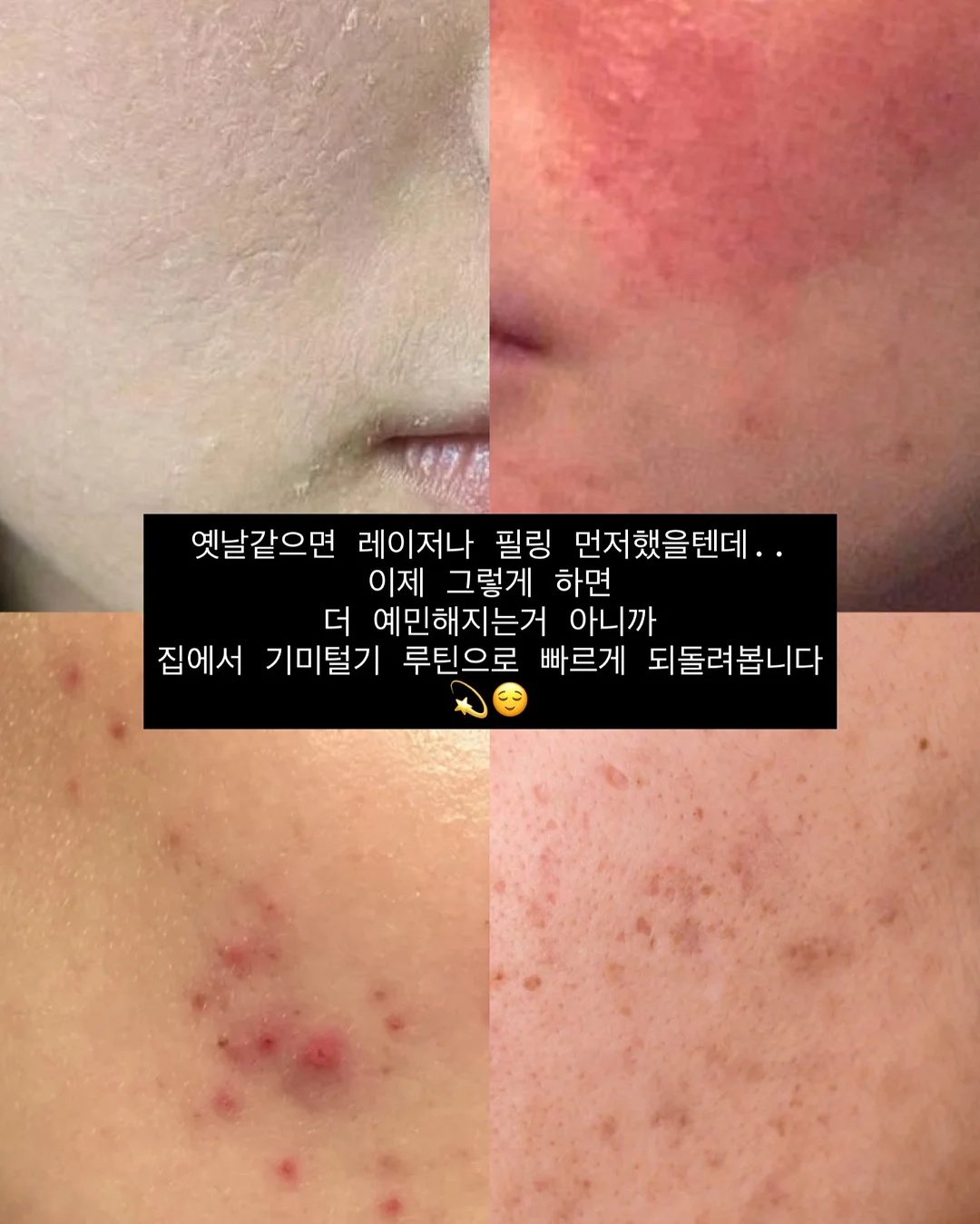 미니 슬라이서 2
