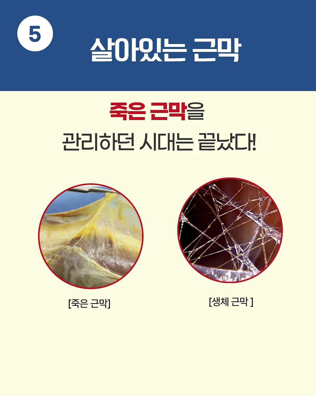 원피스 7