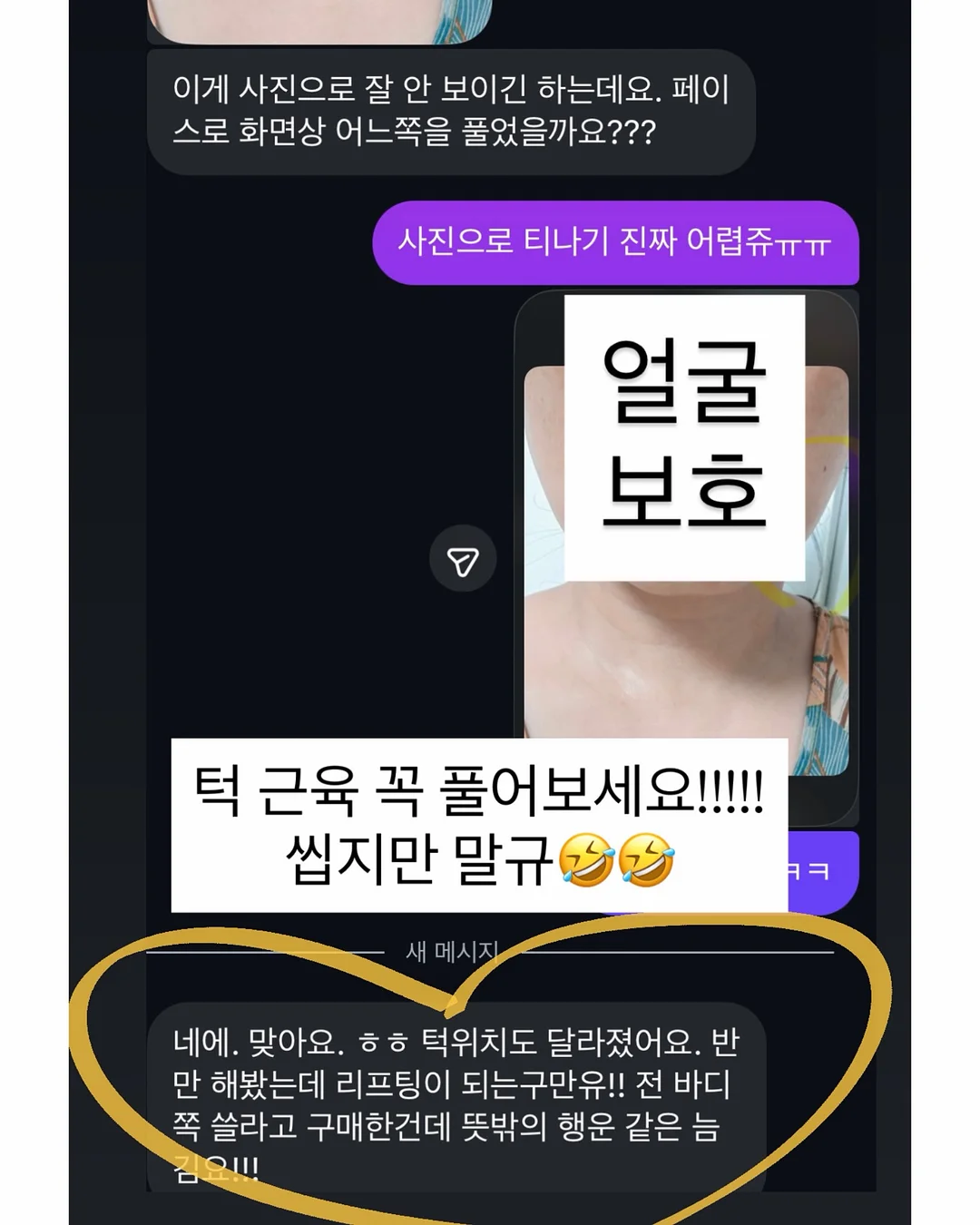 SMC호스 레드가 11