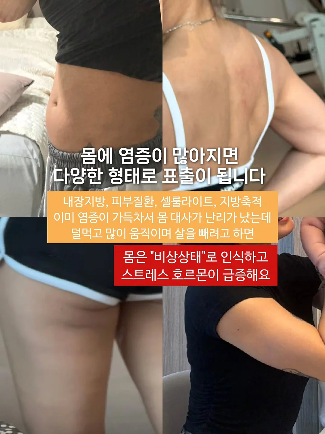 린넨 오픈 카라 셔츠 3