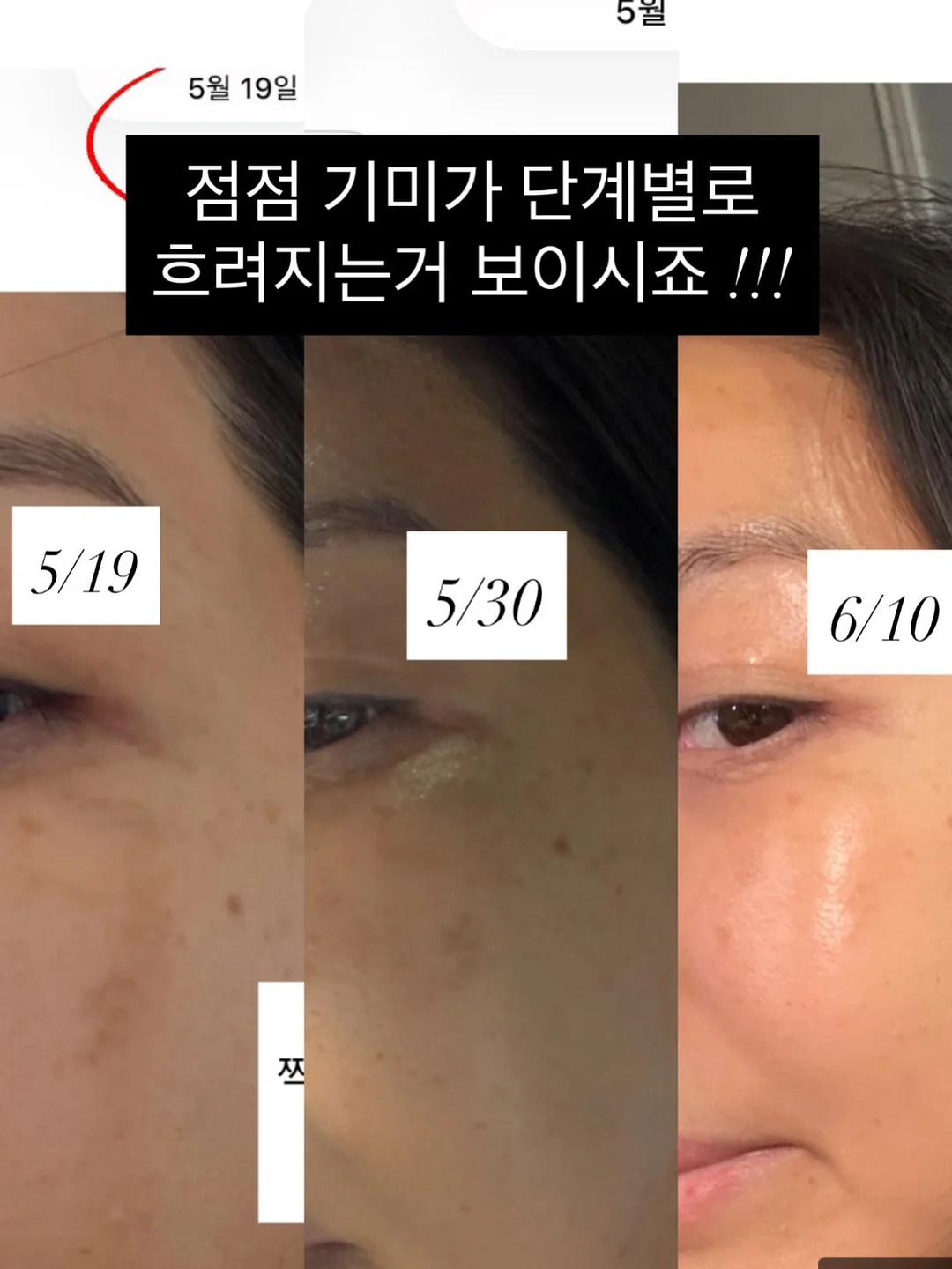 리우드 일포드 상하세트 1