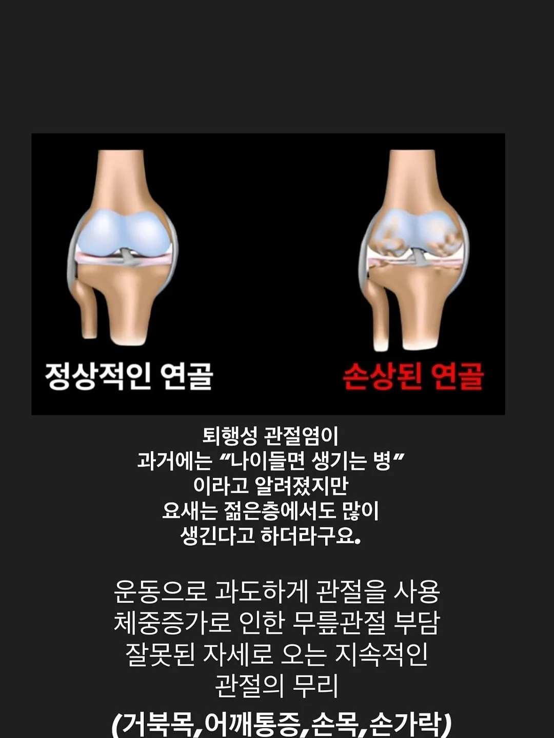 전 기종 호환 방수케이스 3