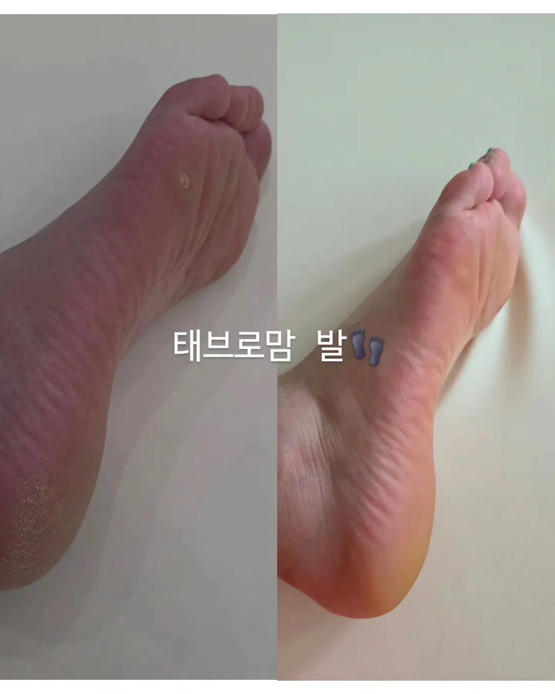 버미큘라 솥밥 8