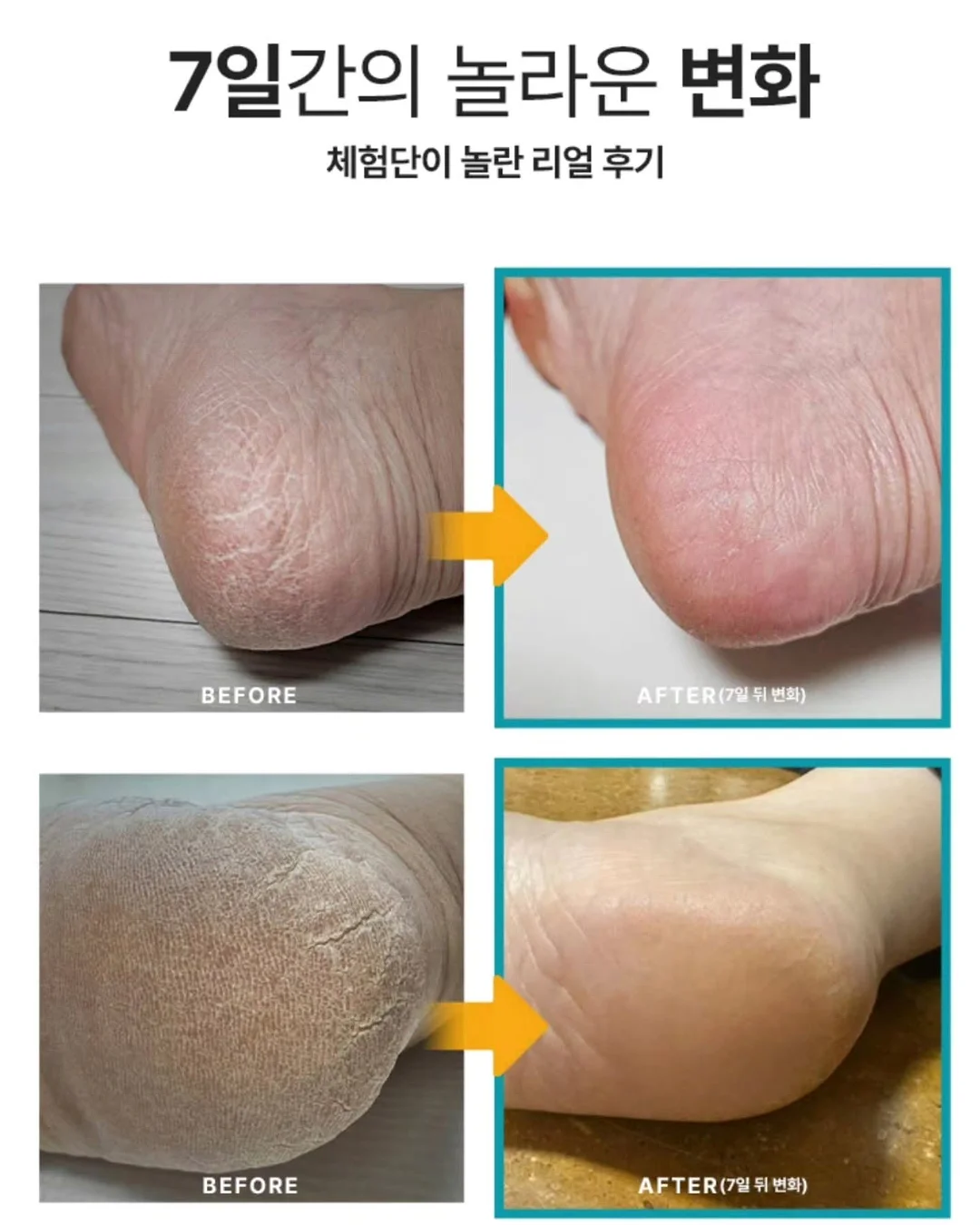 버미큘라 솥밥 9