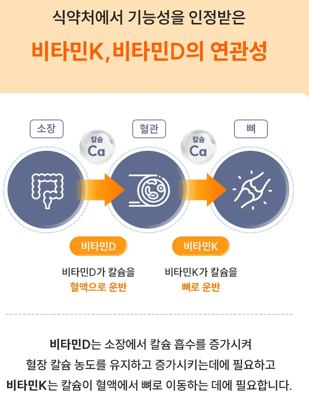 레다 여성 숏 바람막이 15