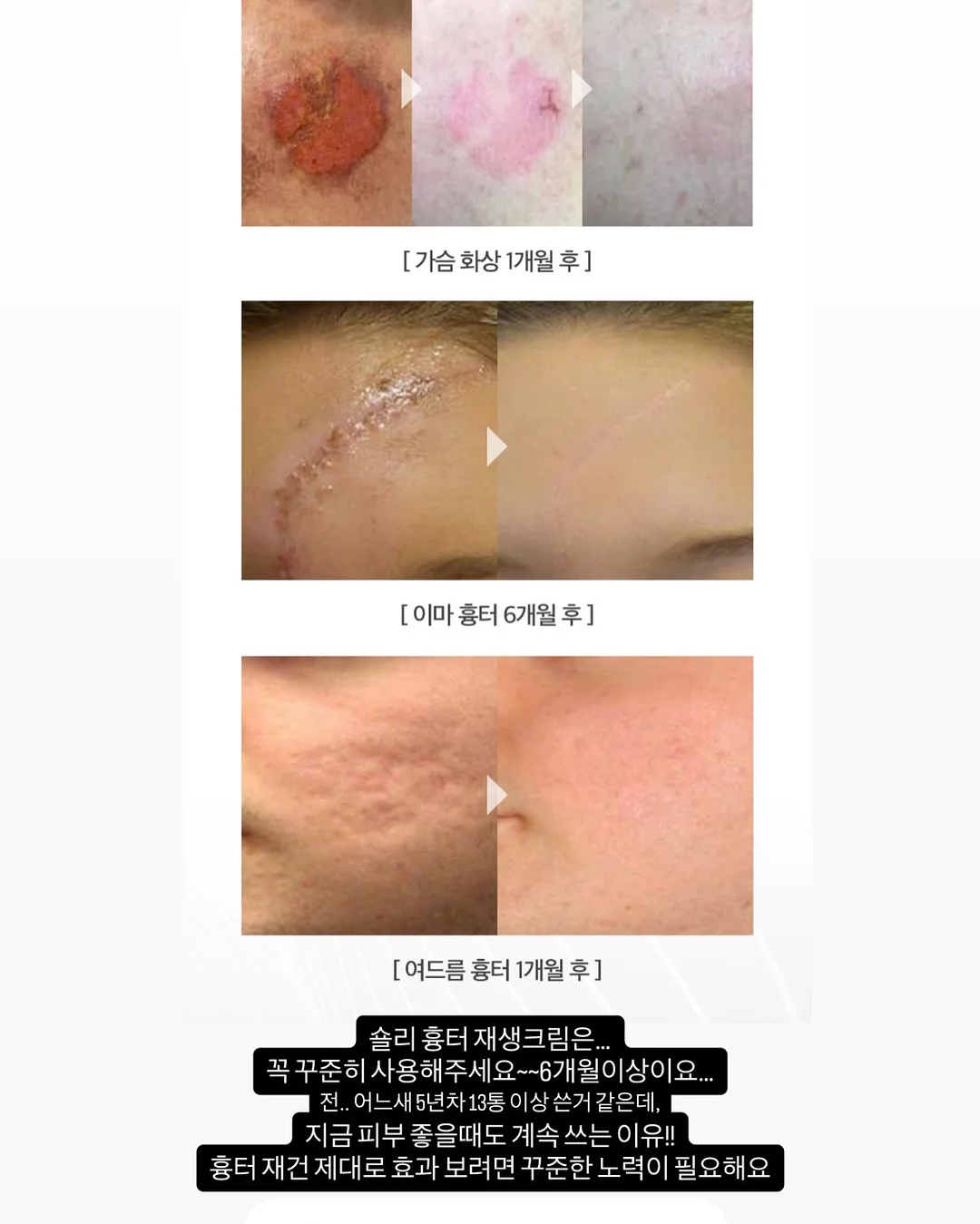 비밀요원 레너드 우리 고전 11