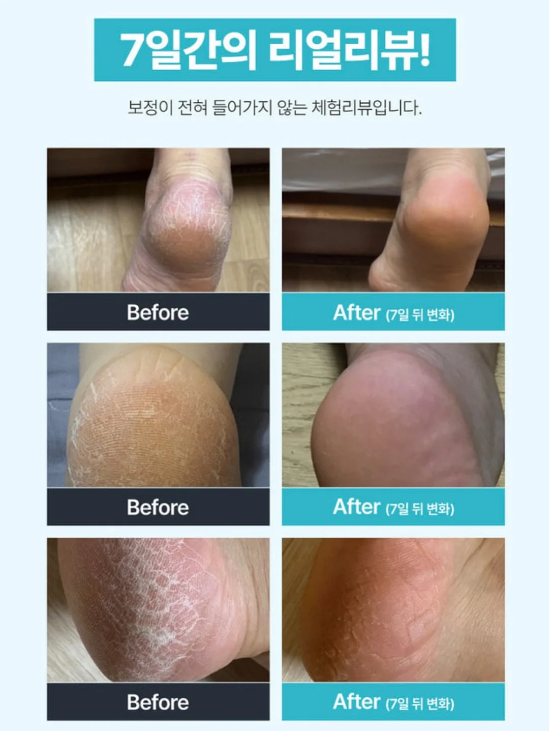래글런 하프코트 3