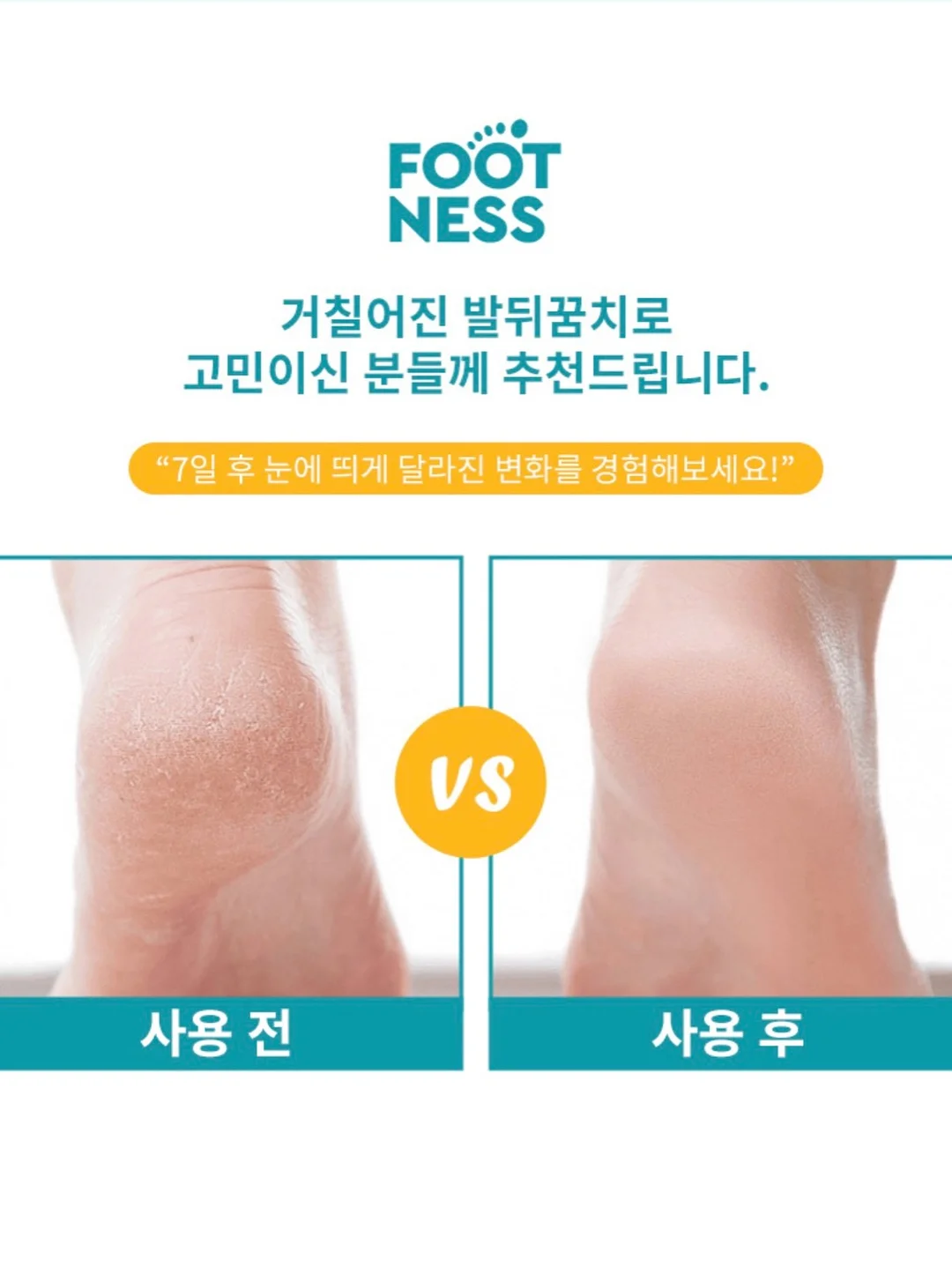 래글런 하프코트 4