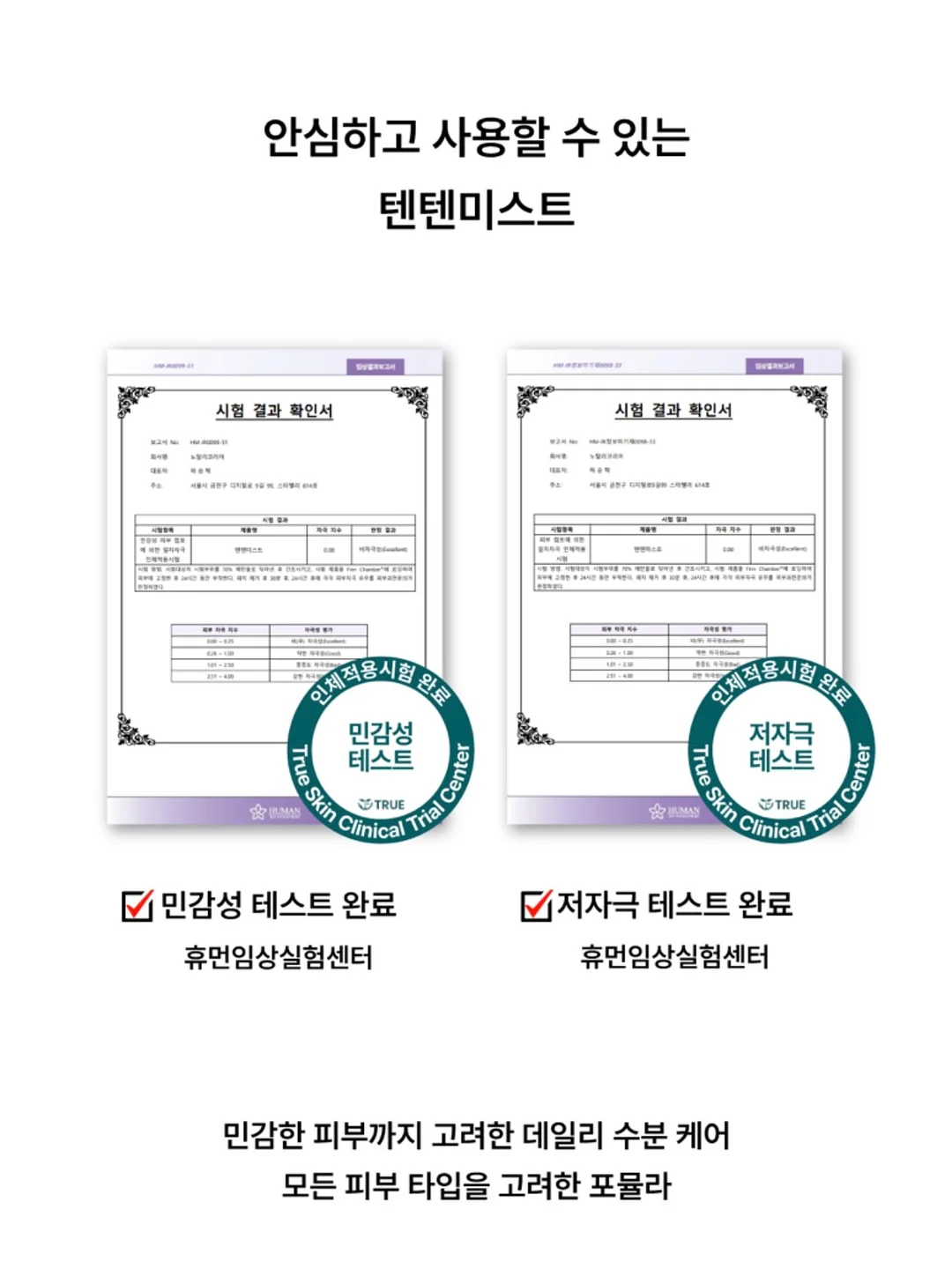 비앙코 원피스 8