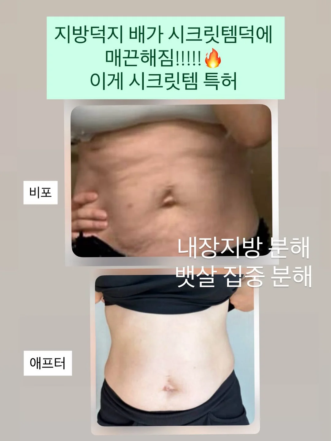 청첩장 5
