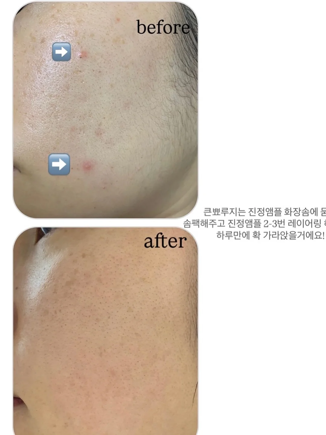물놀이장 4