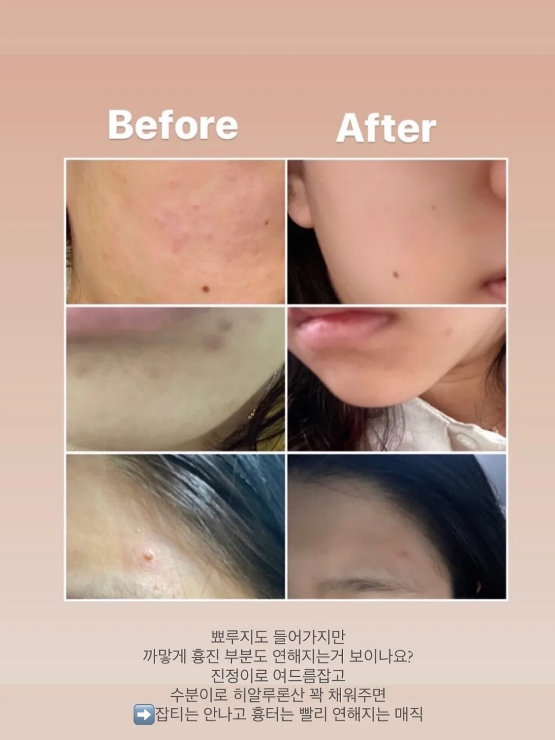 물놀이장 8