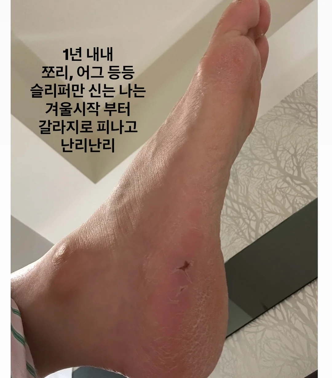 아이엔젤 닥터다이얼 플러스 아기띠 2