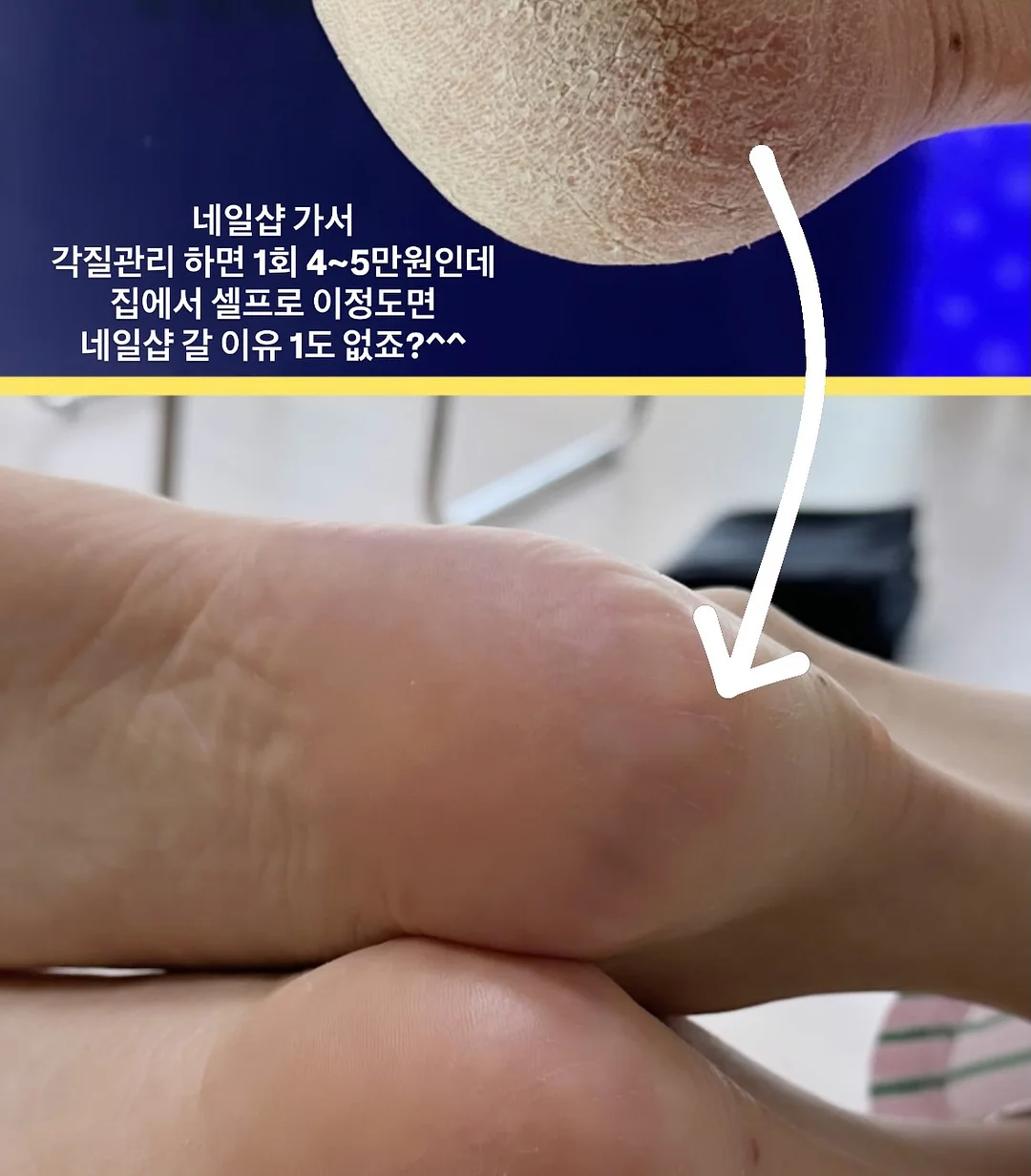 아이엔젤 닥터다이얼 플러스 아기띠 8