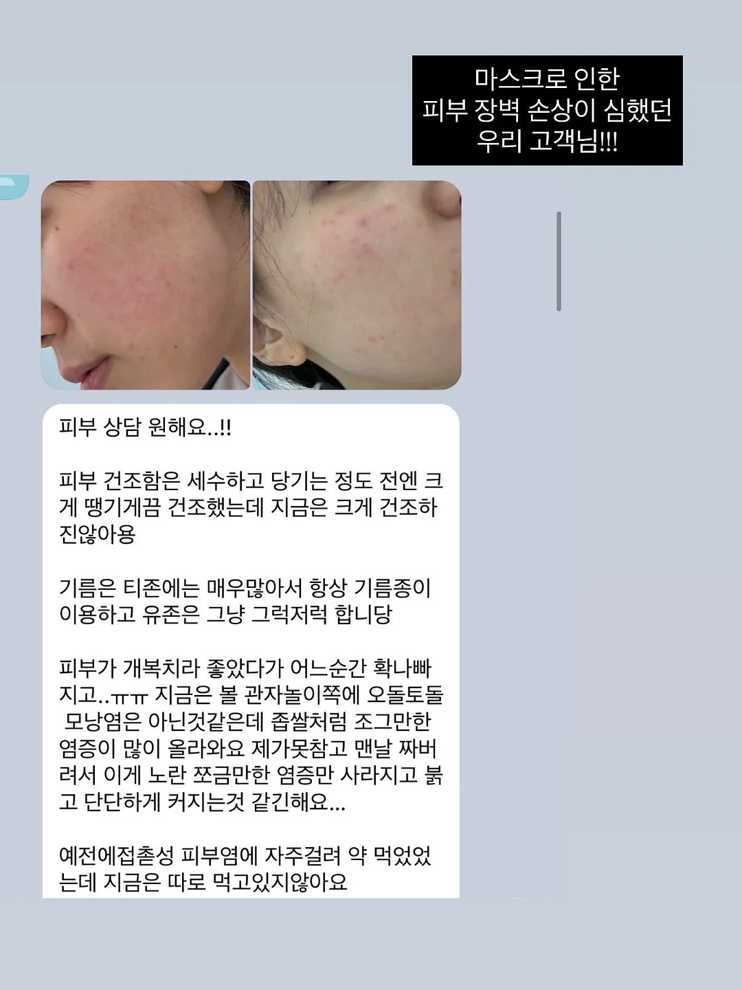 붙임머리 2