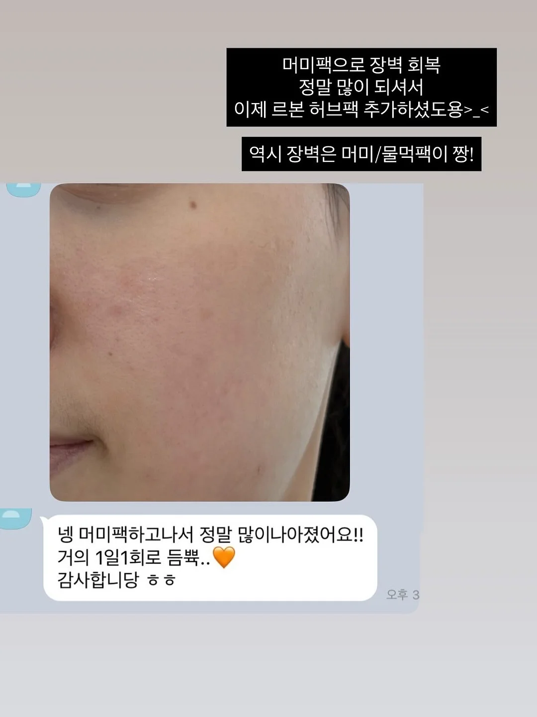 붙임머리 3