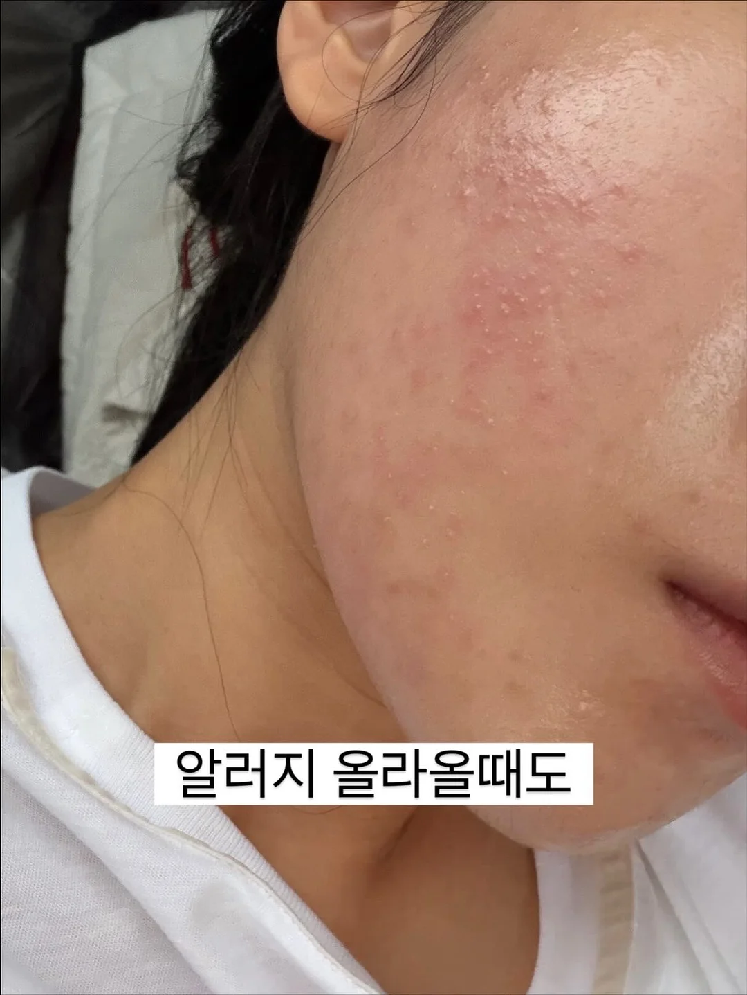 붙임머리 4