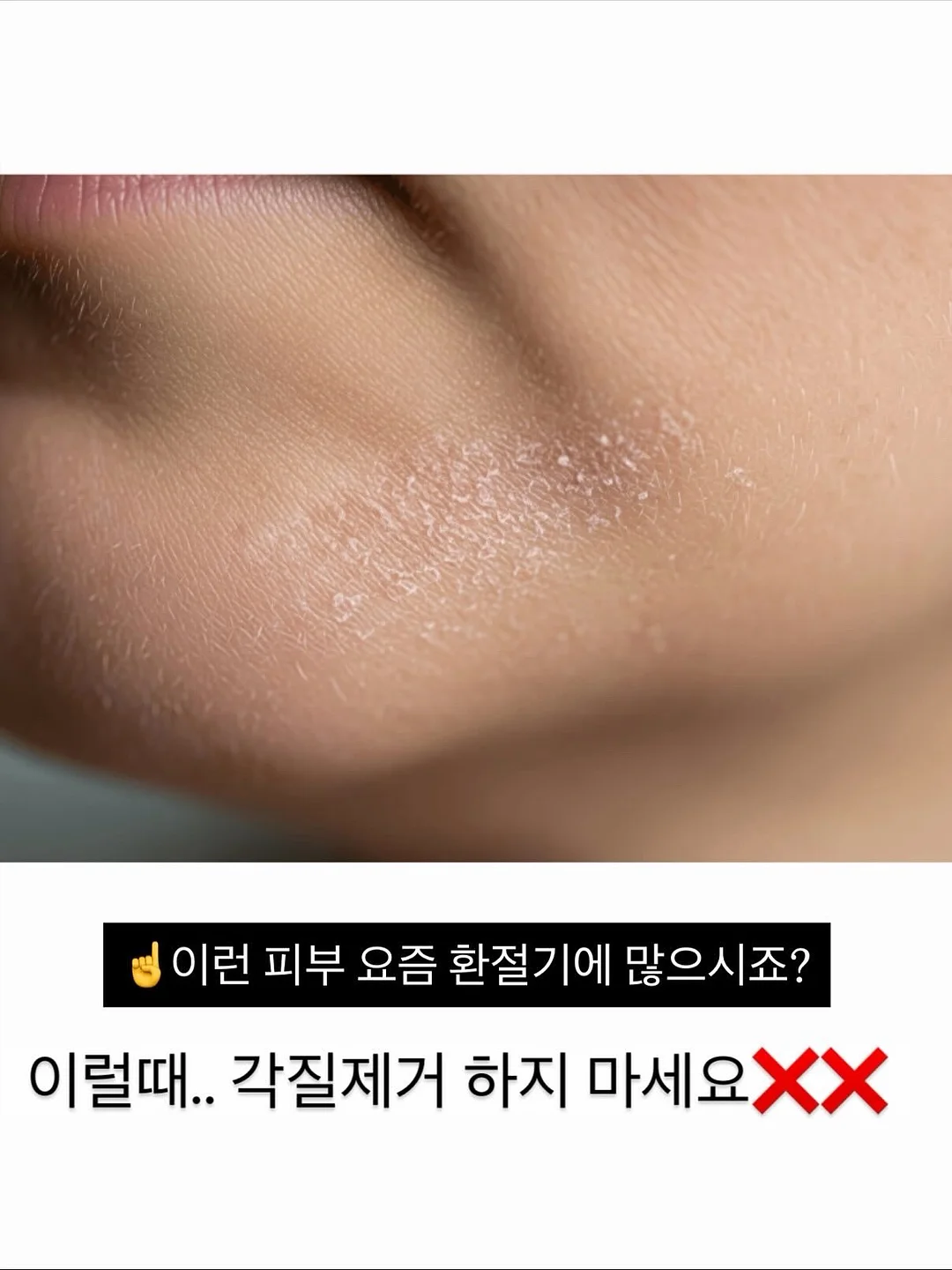 붙임머리 6