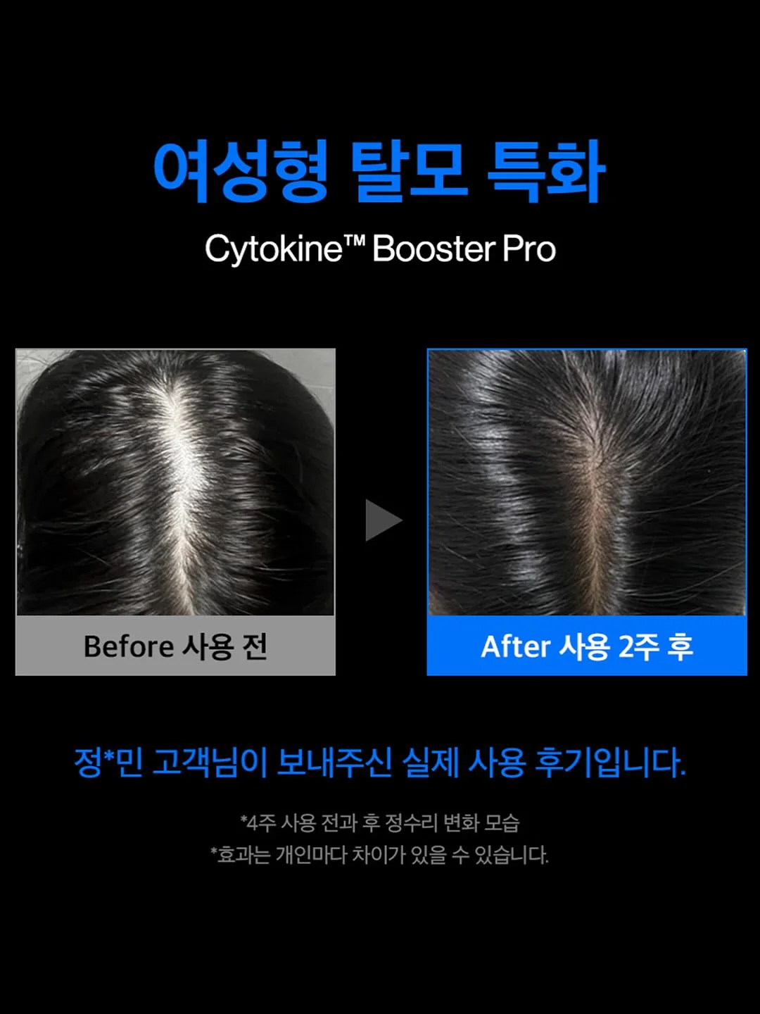 믹스 테리 주방장갑 7