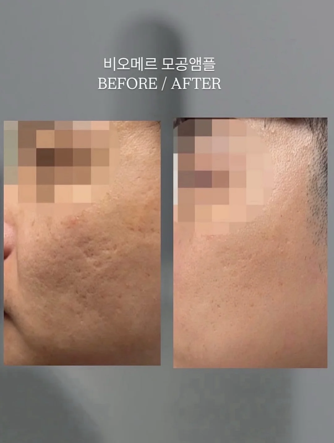 3초 보냉백 7